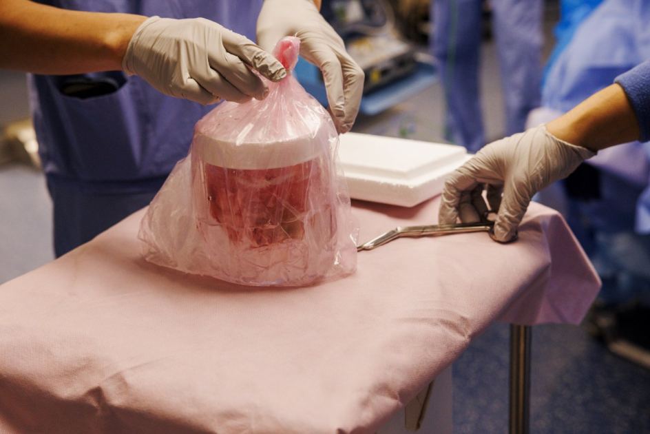 Pig kidney kept a man off dialysis for nine months in world first