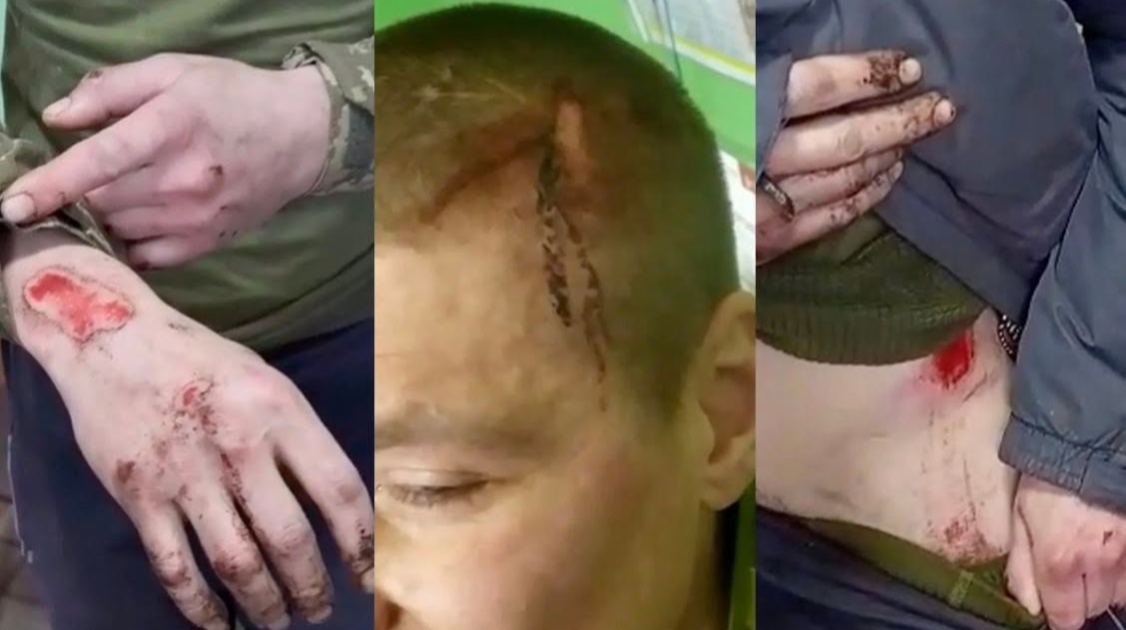 ЗМІ встановили 26 небойових смертей серед новобранців "Скелі" від кінця 2025 року