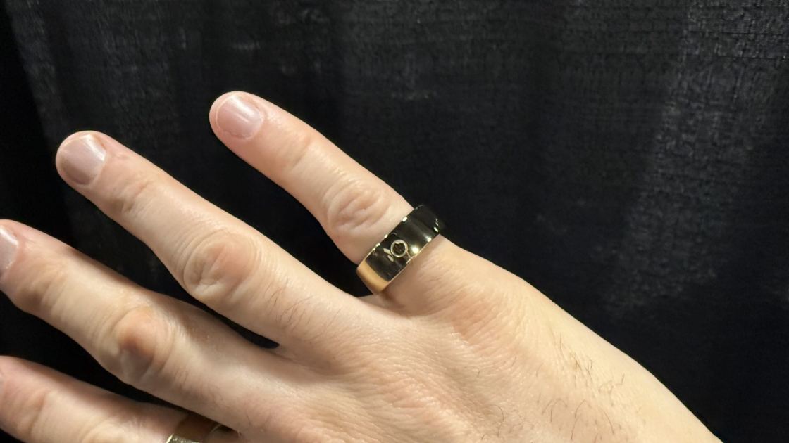 Circular Ring 2 moves into the clinic with the new Team Dashboard