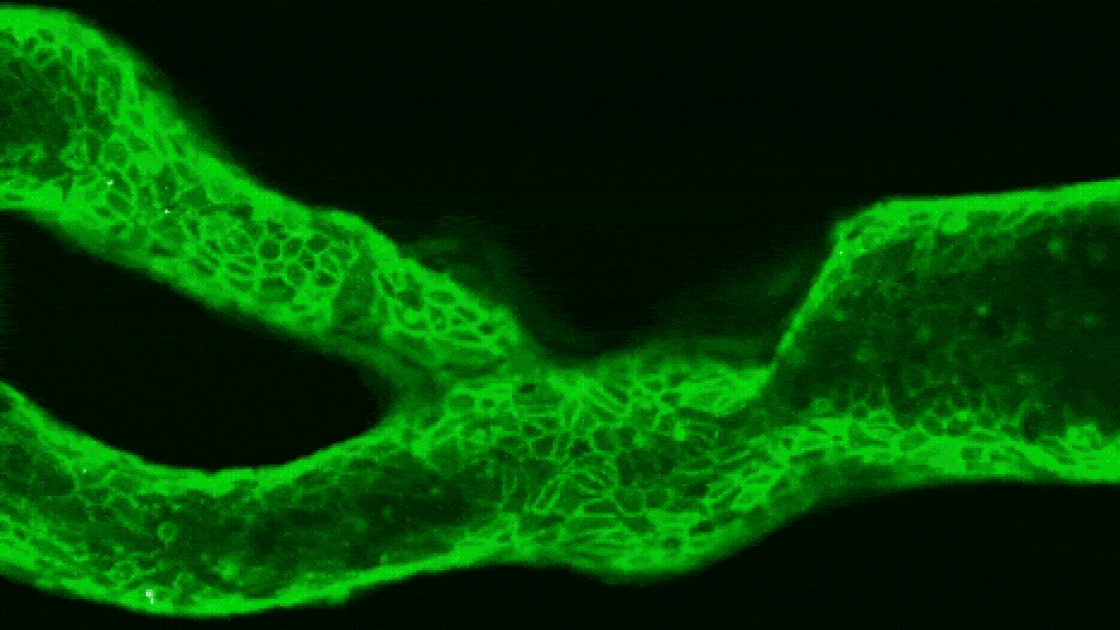  Mini 'arteries-on-a-chip' could help predict a person's risk of stroke 