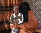 Guardian readers fund life-changing surgery for Somali boy injured in US airstrike