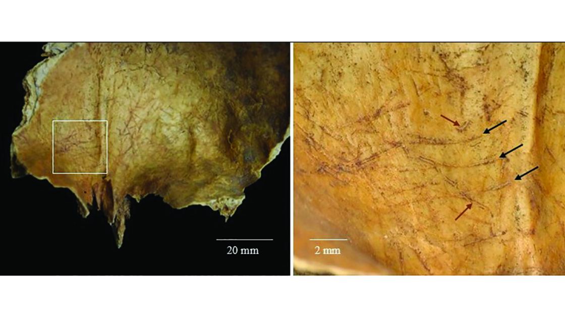  2,000 years ago in Scotland, people removed a corpse's brain and fashioned the arm bones into tools 