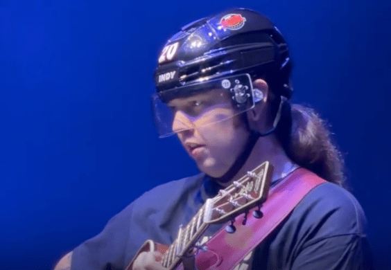 Billy Strings Wears Protective Headgear After Getting Hit By Object The Previous Night