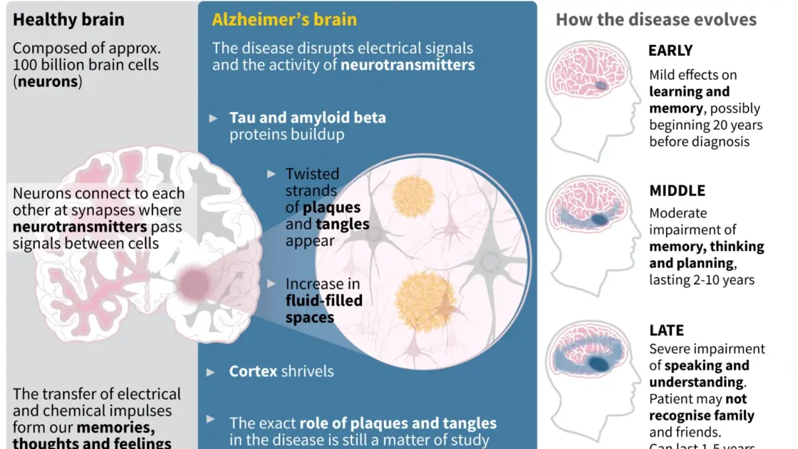 A Simple Test Could Reveal Your Alzheimer’s Risk Years Before the First Symptoms