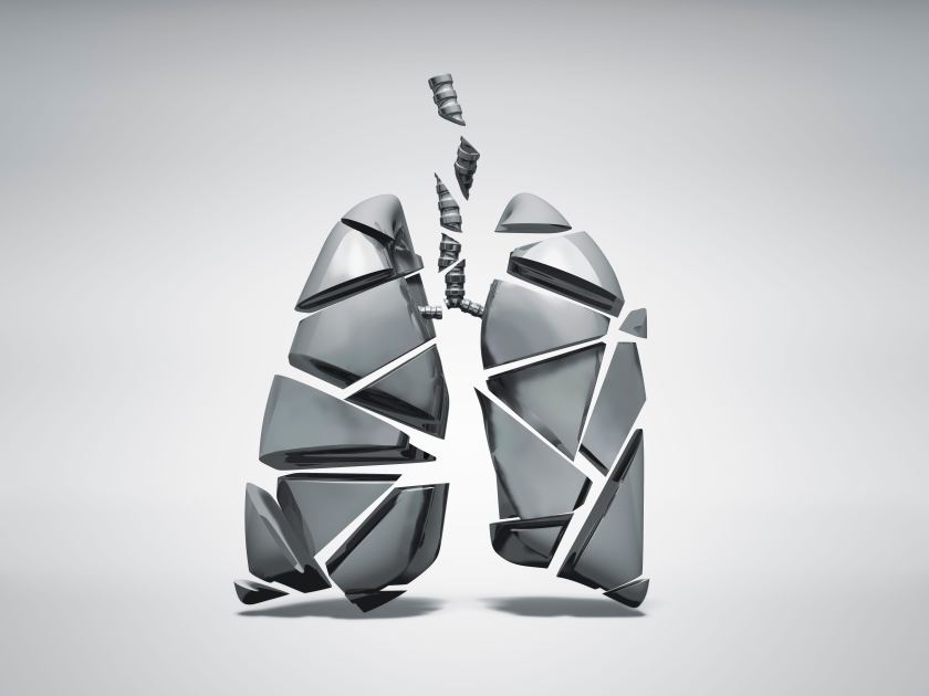 Whoa—This Guy Stayed Alive for 48 Hours Without Any Lungs