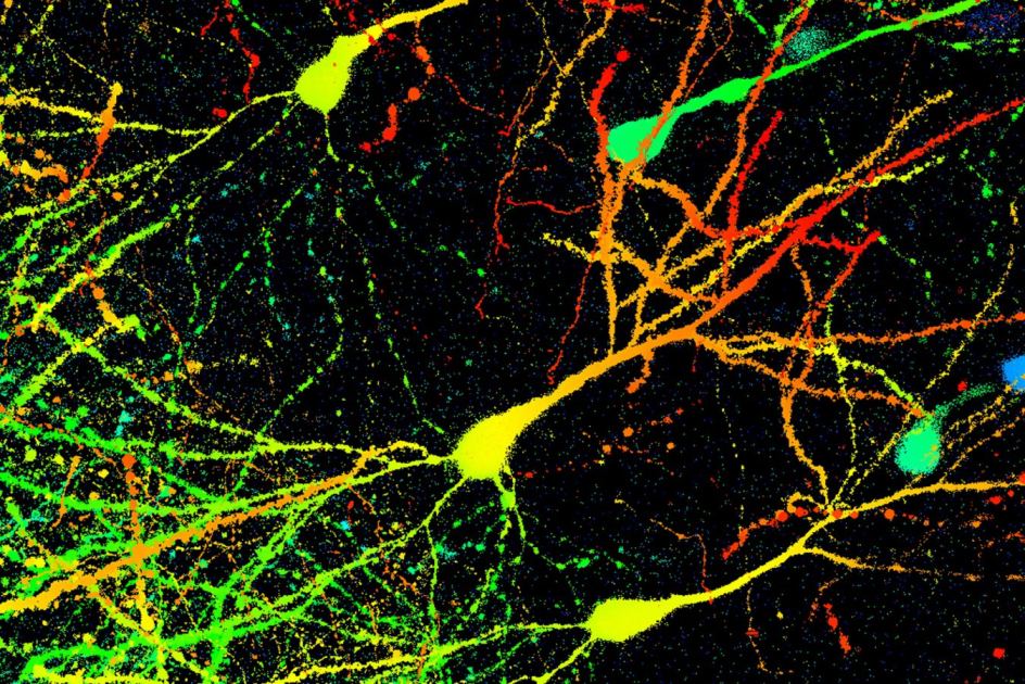 ‘Remarkable’ discovery upends our understanding of how brains store memories