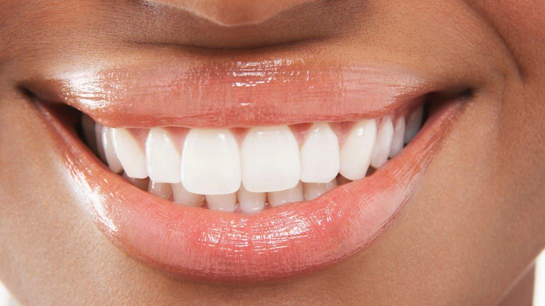 The Best Whitening Toothpastes Dentists Recommend to Their Patients