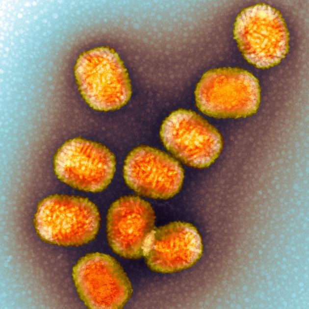 This Virus Stole a Human Gene and Won’t Let Go of It