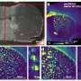 New probe could help trace Alzheimer's-linked lipids one cell at a time
