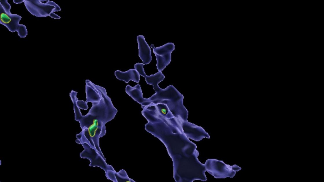  Microplastics that accumulate in the body may 'clog up' immune cells 