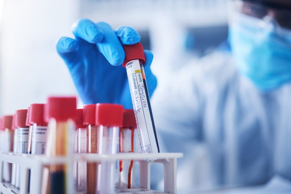 Our blood’s body clock may be causing anaemia cases to be missed