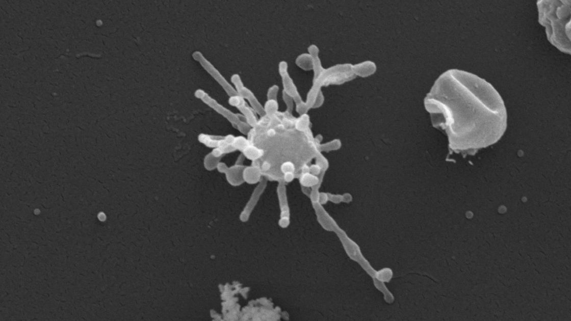  Ancient 'Asgard' microbe may have used oxygen long before it was plentiful on Earth, offering new clue to origins of complex life 