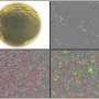 Baker's yeast shows potential in treatment of persistent fungal infection